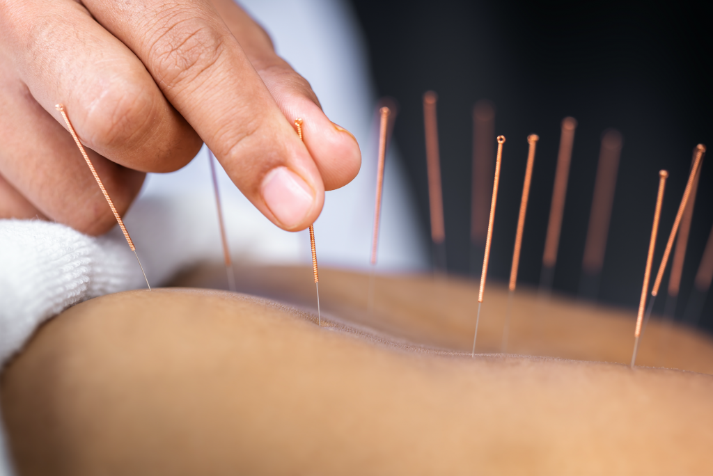 Ruzeen Hettiarachchi, Dr Ruzeen Hettiarachchi, Acunpuncture, medical acupuncture, holistic health, wellness beaconsfield, health beaconsfield, seed wellness, seed beaconsfield, seed acupuncture,